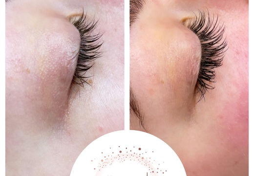 Lashes 